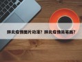 肺炎疫情图片动漫？肺炎疫情简笔画？